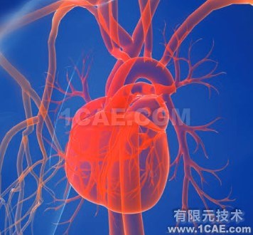 CFD模擬拯救患有致命心臟缺陷的嬰兒 CFD模擬拯救患有致命心臟缺陷的嬰兒