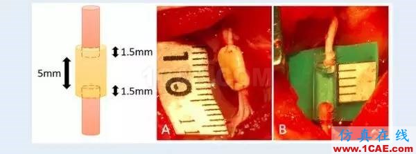 【行業觀察】看制造技術如何造福人類——2017年醫用3D打印技術的七個領域應用進展機械設計圖例圖片8
