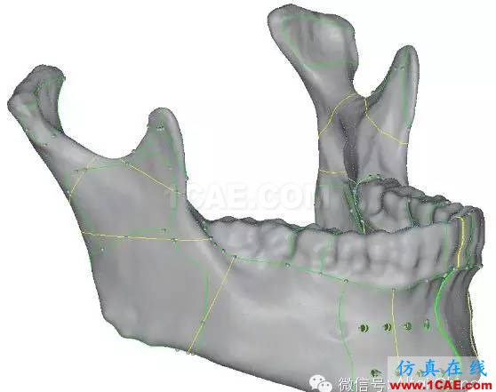 Hypermesh 2015 CAE 有限元網格競賽作品案例hypermesh分析圖片10