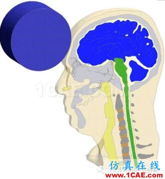 有限元分析在醫療領域的利用cae-fea-theory圖片2