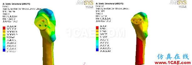 “倒品字”與“品字”空心釘不同Pauwels分型骨折的生物力學性能研討ansys分析圖片5
