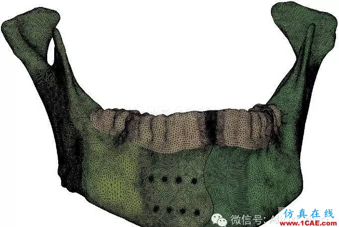 Hypermesh 2015 CAE 有限元網格競賽作品案例hypermesh分析圖片11